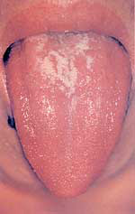 舌質